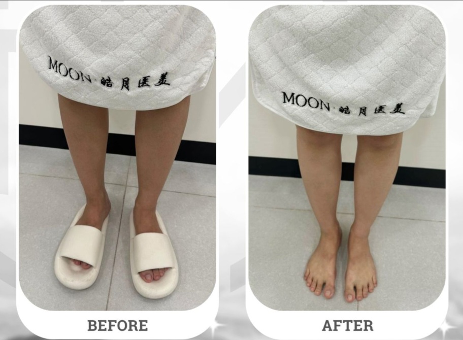 Moon Beauty Luncurkan Whitening Cabin