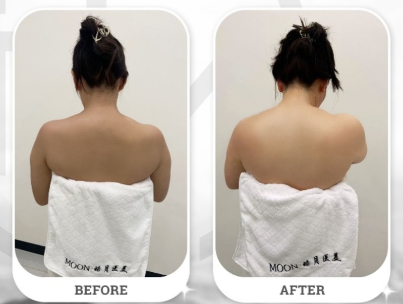 Moon Beauty Luncurkan Whitening Cabin